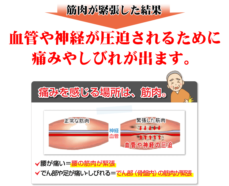 筋肉が緊張した場合、
血管や神経が圧迫されるために、痛みやしびれが出ます。 痛みを感じる場所は、筋肉。 腰が痛い=腰の筋肉が緊張 でん部や足が痛い・しびれる