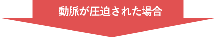 動脈が圧迫された場合