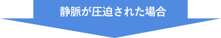 静脈が圧迫された場合